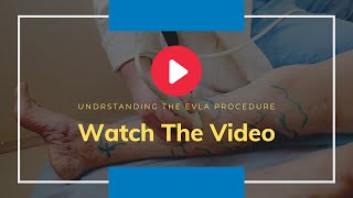 Say Goodbye to Varicose Veins EVLT Minimally Invasive Surgery Explained [upl. by Ibib952]