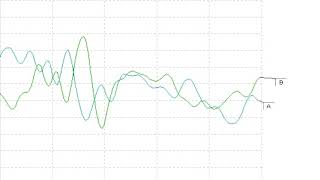 Cochlear Microphonic [upl. by Ihcego]