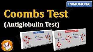 Coombs test or Antiglobulin Test FLImmuno66 [upl. by Corena]