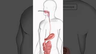 Endoscopy anatomy health 3danatomy [upl. by Shedd]