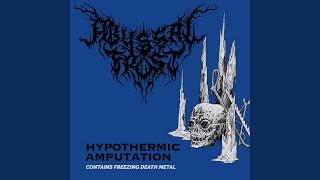 Hypothermic Amputation [upl. by Market]