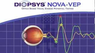 Diopsys NOVAVEP Vision Test  Eye Care [upl. by Roid]