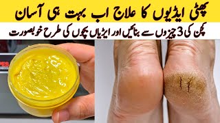 Remove Cracked Heels At Home  Get Beautiful Feet Permanently  Home Remedies [upl. by Faubert]