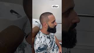 haarschnitt barber تدريج barbershop haircut fade keşfet beard [upl. by Forward376]