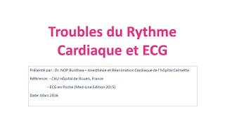 មេរៀនបញ្ហាចង្វាក់បេះដូងTrouble de Rythme Cardiaque et ECG បកស្រាយជាភាសារខ្មែរដោយ​ Dr NOP Bunthea [upl. by Marpet]