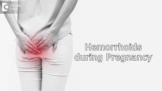 How to manage Hemorrhoids during Pregnancy  Dr Rashmi Chaudhary [upl. by Sivrat872]