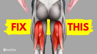 How to Fix a Tight Hamstring for Good [upl. by Renraw]