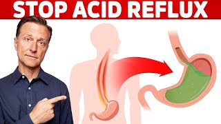 How to STOP Acid Reflux Instantly [upl. by Najib]