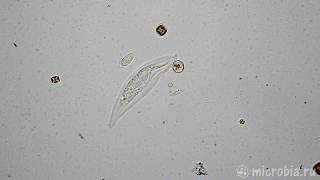 Litonotus eats 2 ciliates  Литонотус съедает 2х инфузорий [upl. by Box927]