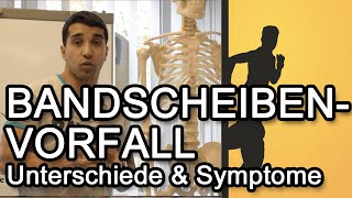 Bandscheibenvorfall  Unterschiede amp Symptome [upl. by Arateehc194]