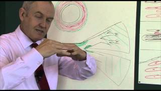 Heart disease 6 Pathophysiology of coronary heart disease [upl. by Dorin]