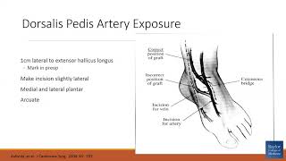 quotDorsalis Pedis Artery Exposure  How I Do Itquot [upl. by Trude]