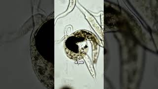 Dois protozoários caçadores disputam a mesma presa microbiologia microorganismos [upl. by Einhoj]