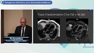 T Karamitsos  Cardiac MRI Basic knowledge for the clinical cardiologist [upl. by Konyn131]