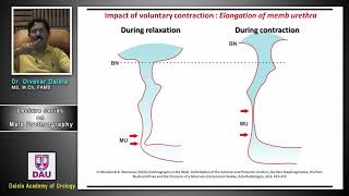 Lecture 5 on male urethrography [upl. by Yerocal127]