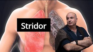 STRIDOR Inspiratory sound due to turbulent air flow in the larynx [upl. by Refinaj]