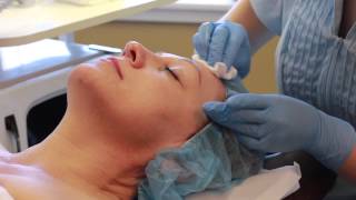 Micropeel Demonstration [upl. by Berkeley]