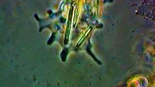 Amoeba with ingested Diatoms [upl. by Kinata]