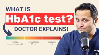 HbA1c Test Explained in Detail  Dr Shailesh Singh  Hindi [upl. by Okramed]