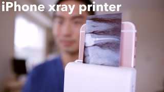 iPHONE XRAY PRINTER for DENTISTS [upl. by Ledua757]