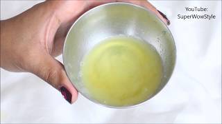 Get Rid of dandruff in 1 Day  Instant Dandruff Remedy at Home [upl. by Short359]