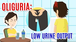 Oliguria poor urine production Causes diagnosis and care [upl. by Teplitz]