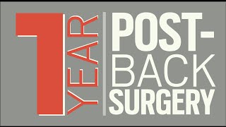 Laminectomy Discectomy L4L5  1 year postsurgery [upl. by Yenwat]