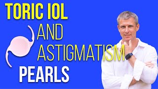 Toric IOLs and astigmatism perls for cataract surgery [upl. by Eitsyrc]