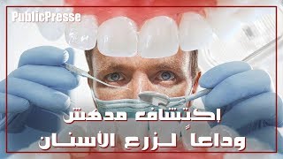 إكتشاف مدهش وداعاً لزرع الأسنان تقنية جديدة لنمو أسنانكم في 9 أسابيع [upl. by Aitekram333]