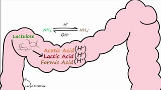 Hepatic Encephalopathy and Lactulose [upl. by Airec641]