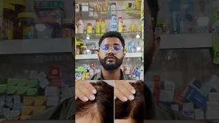 Best hair growth supplement best Hair fall medicine Akashmedicalgyan shorts vitamincskincare [upl. by Eidroj295]