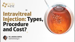 Intravitreal Injection Types Procedure and Cost Dr Anisha Gupta  Eye Specialist Delhi Excel Eye [upl. by Mieka221]