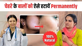 Facial Hair को किया बिना Laser के ठीक  Patient Review Hirsutism Ayurvedic Treatment 100 Results [upl. by Assylem206]