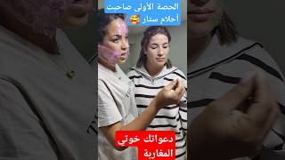 الحصة الأولى عند حنان إزالةالكلف اكسبلور ازالةالتجاعيد تيكتوك ترند tattoo [upl. by Laehctim422]