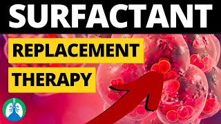 Surfactant Replacement Therapy Medical Definition  Quick Explainer Video [upl. by Adall]