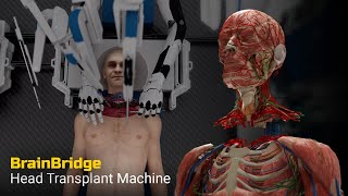 Head Transplant Machine – BrainBridge [upl. by Yecniuq289]