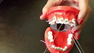 Placing a stainless steel ligature wire for Braces [upl. by Adnowat]