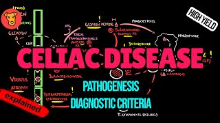 CELIAC DISEASE Pathogenesis Diagnostic markers HLADQ28 Antibodies Biopsy Treatment Explained [upl. by Pier]