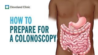 Tips to Prepare for Your Colonoscopy [upl. by Aileduab700]