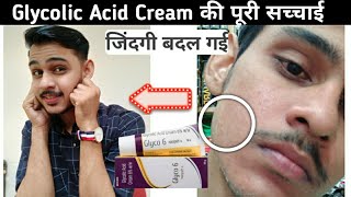 Glycolic acid cream  Remove Pigmentation Dark Spot Acne Pimple Acneamp Pimple Scars skin white [upl. by Esta17]