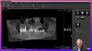 Dental Treatment Planning in a Medically Compromised Case [upl. by Ludovick96]