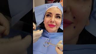 Thread Lift Doctor  Jowl Lift Procedure from Start to Finish [upl. by Naujit]