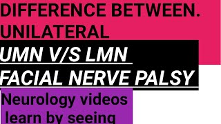 Difference between UMN vs LMN facial nerve palsy unilateral [upl. by Ediva]