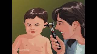 Otoscope  Otolaryngology [upl. by Nonah603]