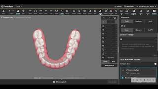 Settting up a clincheck with more realistic less idealistic tooth movements [upl. by Serena478]