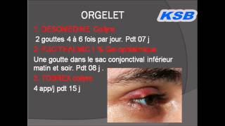 Ordonnances types en ophtalmologie [upl. by Lurline]