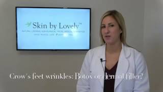 Botox or dermal filler for quotCrows feetquot wrinkles [upl. by Colligan]