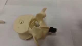 Typical Vertebra Parts 1 of 2 [upl. by Deina]