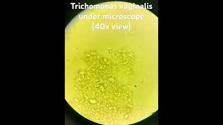 Trichomonas under microscope 40xview Pathology [upl. by Howlan621]