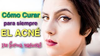 👍 Cómo CURAR el ACNÉ 😱 de forma NATURAL 4 SECRETOS [upl. by Durnan]